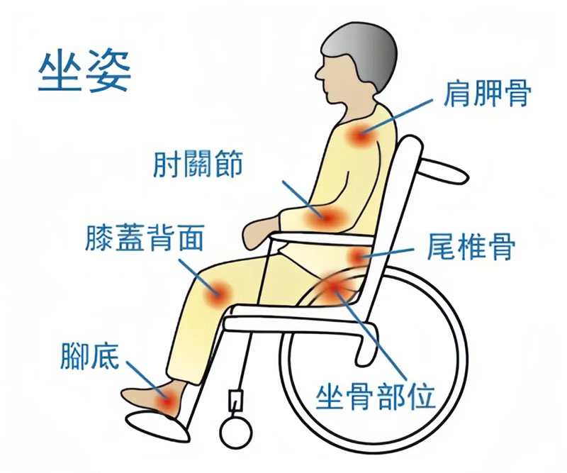 宁波海曙顾连康复医院开展压疮知识培训活动